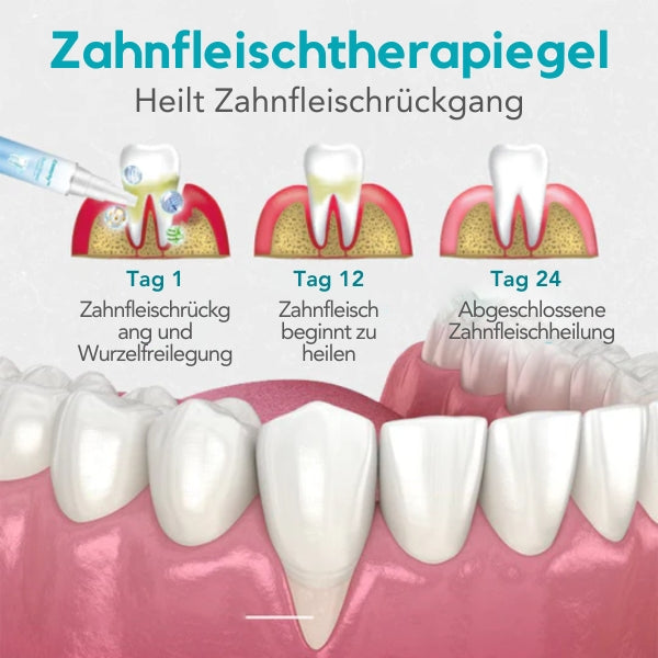 GumShield | Medizinisches Gel für ein gesundes Zahnfleisch