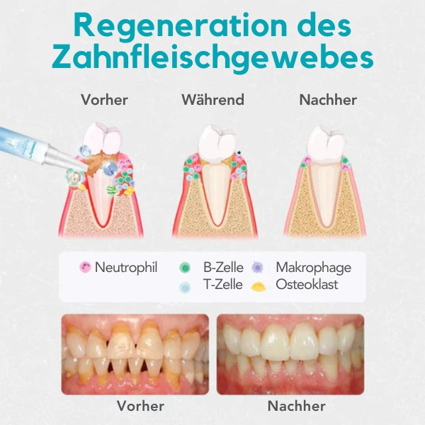 GumShield | Medizinisches Gel für ein gesundes Zahnfleisch