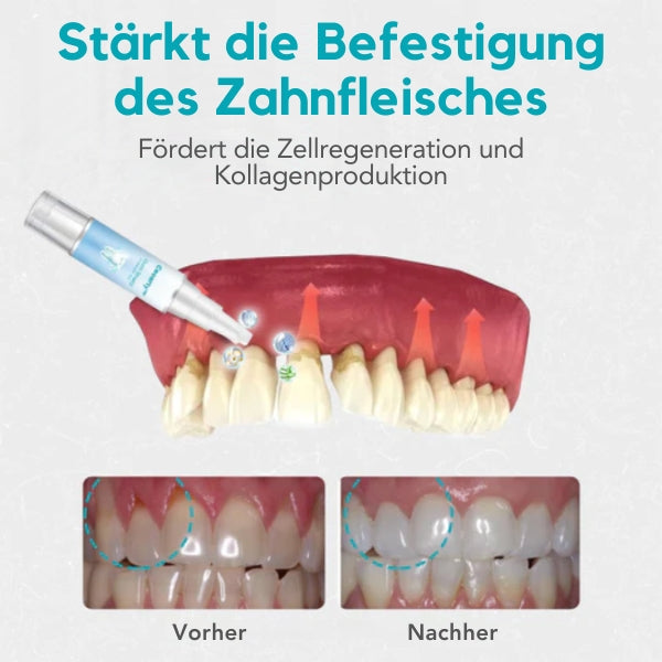 GumShield | Medizinisches Gel für ein gesundes Zahnfleisch